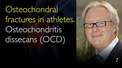 运动员的骨软骨骨折，即分离性骨软骨炎（Osteochondritis Dissecans，简称OCD）。