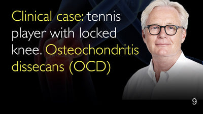 临床病例：网球运动员膝关节交锁，诊断为剥脱性骨软骨炎（OCD）。病例编号：9。